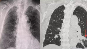 Doktorları şaşırtan röntgen: Aylarca kapalı olan odada kaldı sonuçlarına kendisi bile inanamadı