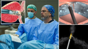 Uzman isim Rezum yöntemini açıkladı: Sadece 7 dakika sürüyor hasta 3 saat sonra taburcu ediliyor