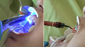 Uzmandan şaşkına çevirecek sözler: Beyazlatma işleminde çamaşır suyu kullananlar var