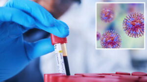 Yüzlerce şişe dolusu ölümcül virüs kayboldu: İmha mı edildi?