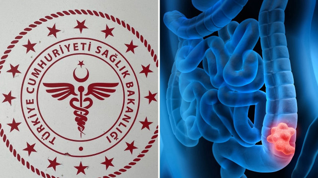En sık görülen üçüncü kanser türü olarak biliniyor: 50 yaşından sonra riski artıyor