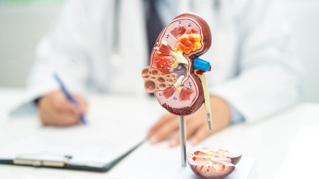 İdrardaki değişiklikler böbreklerde hastalık sinyali verebilir