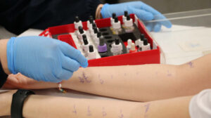 Alerjik rinitin astıma ilerleme riski nedeniyle erken tanı ve tedavi önemli