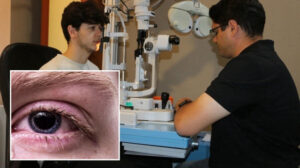 Bahar aylarında göz alerjilerine dikkat