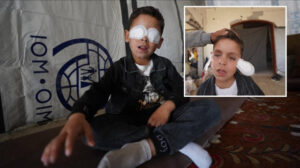 Gazze’deki saldırılardan dolayı 1500 kişi görme yetisini kaybetti