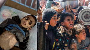 Gazze’den dünyaya çağrı: Açlıktan ölen çocukları kurtarın