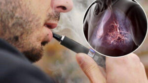 Gençleri tehdit ediyor: Elektronik sigara kullananlar dikkat