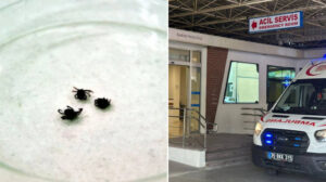 Sivas’ta vücuduna kene yapışan genç kadın hayatını kaybetti