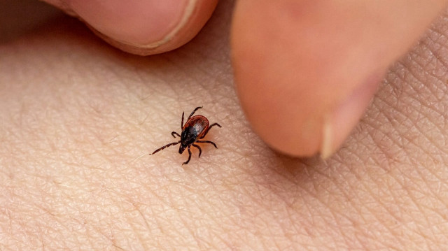 Uzmanlar uyardı: Kene kesinlikle elle çıkartılmamalı