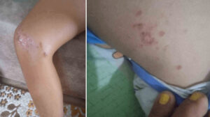 Antalya’da korkunç şüphe: Denizden çıkan çocuk bir anda fenalaştı