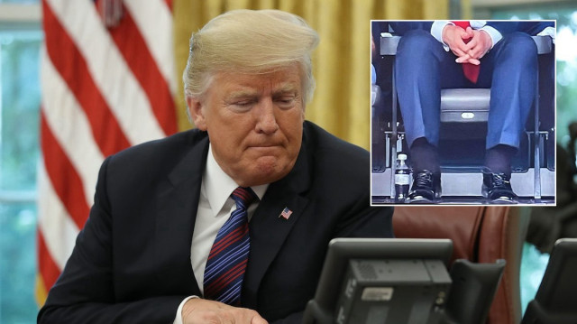 Bacaklarındaki şişlik dikkat çekmişti: Beyaz Saray Trump’ın yakalandığı hastalığı açıkladı