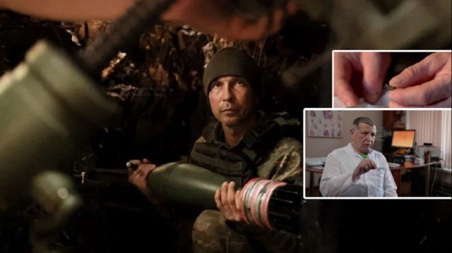 Cephede hayatını mıknatıs kurtardı: ‘Kalbimden şarapnel çıkardılar’