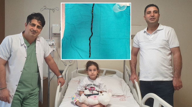 Doktorları bile şoke etti: 3 yaşındaki çocuğun mide ve bağırsağı delindi