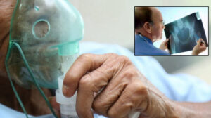 Erkeklerde ‘sessiz hastalık’: Gittikçe yaygınlaşıyor