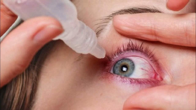 Uzmanı uyardı: Kuru göz hastalığında steroid kullanımına dikkat