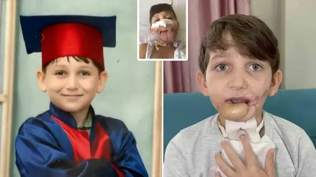 10 yaşındaki çocuk tüfekle çenesinden vuruldu