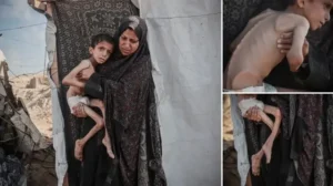 Gazze’de 10 yaşındaki çocuk ağır yetersiz beslenme ile karşı karşıya