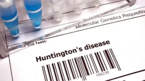 Huntington hastalığında tarihi gelişme: Yeni tedavi yüzde 75 yavaşlatıyor