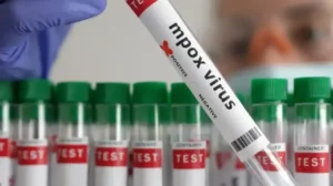 Hastaneden açıklama geldi: İlk vaka tespit edildi! Hem hayvandan hem insandan bulaşıyor