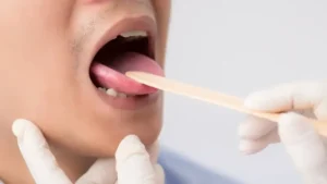 Dil rengi ve dokusu sağlık sorunlarının habercisi olabilir