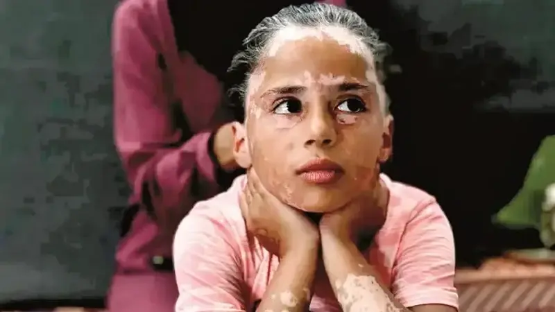 Gazzeli çocukların travması bitmedi