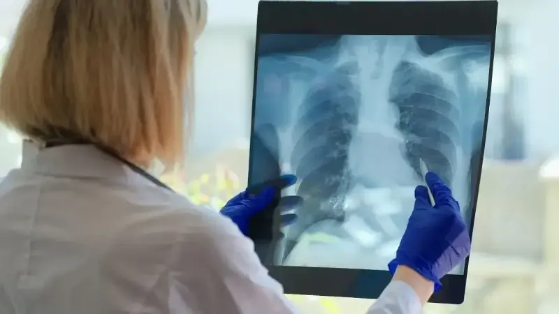 İleri evre akciğer kanserinde ‘yenilikçi tedavi’ dönemi