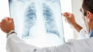 Tekrarlayan zatürre, akciğer kanserinin habercisi olabilir