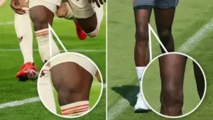 80 milyon Euroluk yıldızın eski halinden eser yok: Kas kaybı dikkatlerden kaçmadı