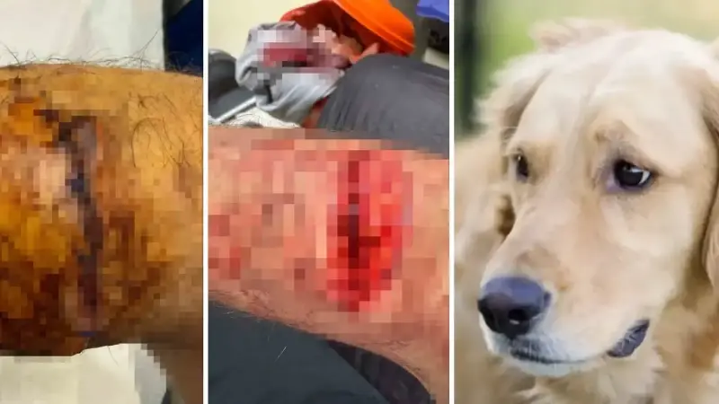 Başakşehir’de sitenin güvenlik görevlisine sahipli köpek saldırdı: Bu kez pitbull değil Golden cinsi köpek parçaladı