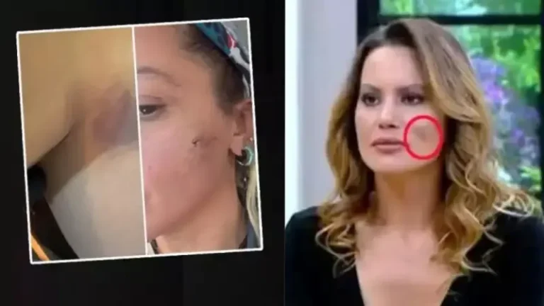 ‘Eşim şiddet uyguluyor!’ deyip yüzündeki morlukları paylaştı: Ünlü oyuncunun yardım çığlığı sosyal medyayı salladı