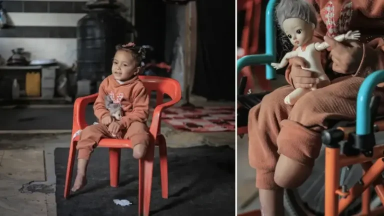 Gazze’de saldırıda yaralanan 4 yaşındaki Rawan’ın protez umudu