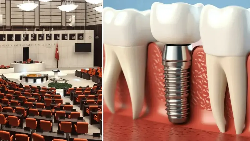 Milyonları ilgilendiren teklif Meclis’e sunuldu: İmplant tedavisini SSK karşılayacak