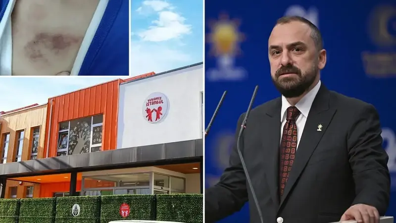 AK Partili Acar’dan kreşte darp iddiasına ilişkin İBB’ye sert tepki: Tek vaadi vurgun olan liyakatsiz zihniyetin ihaneti