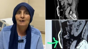 Kafatası kemiği sekiz ay karnında saklandı: Nakille sağlığına kavuştu