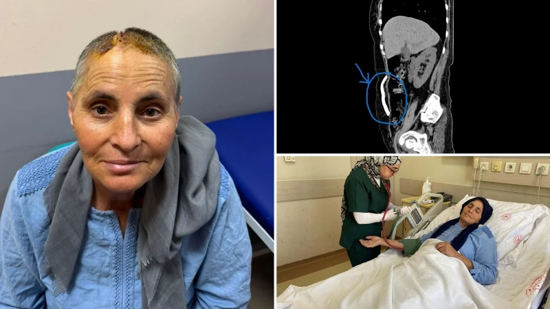 Ne bebek ne de kitle: 8 ay boyunca karnında kafatası kemiği taşıdı: 3 çocuk annesinin akılalmaz hikâyesi