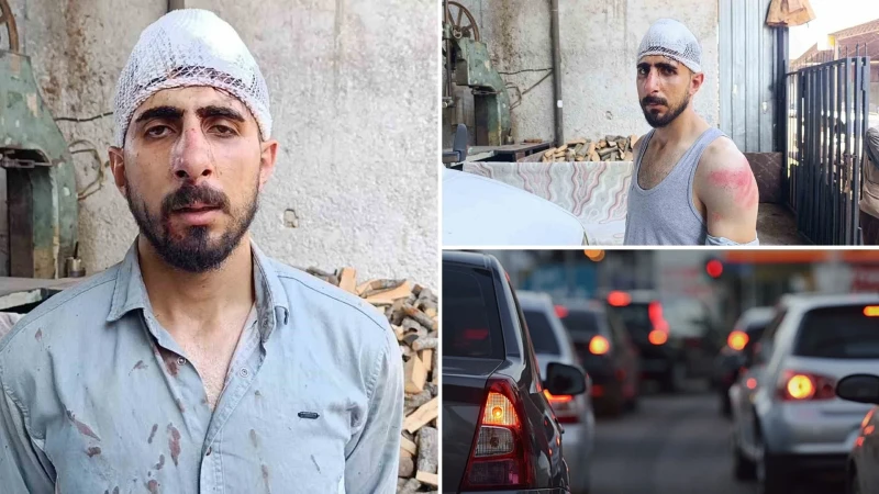 Şanlıurfa’da trafikte yavaş giden sürücüye meydan dayağı: Burnu kırıldı başına 8 dikiş atıldı
