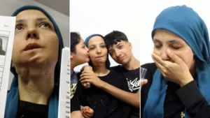 Üç çocuk annesi kadın 11 yılda 35 ameliyat geçirdi: Son ameliyatı olmazsa dili alınacak