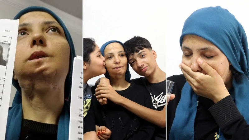 Üç çocuk annesi kadın 11 yılda 35 ameliyat geçirdi: Son ameliyatı olmazsa dili alınacak